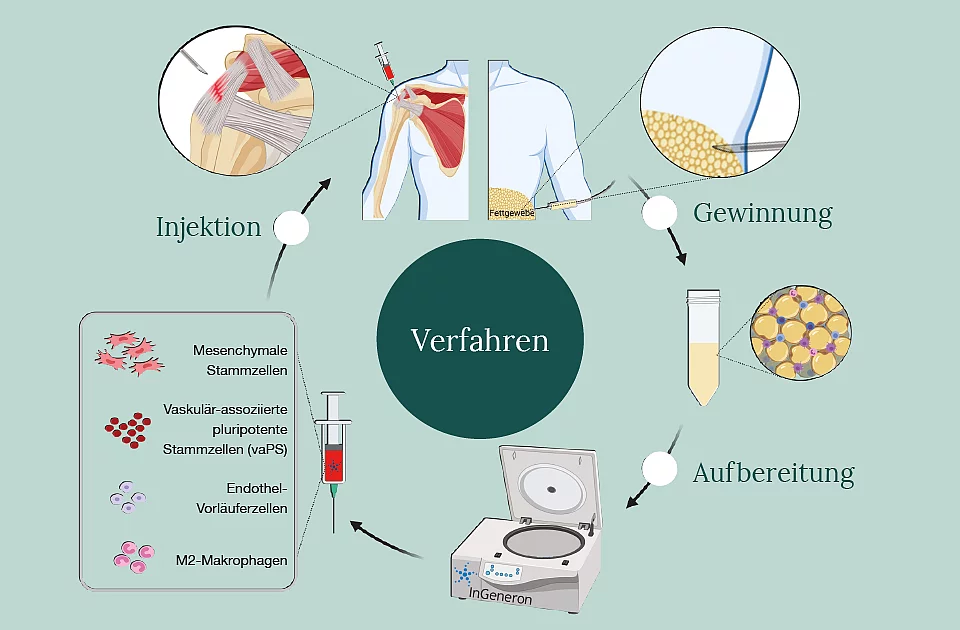 Das Verfahren des integratives Konzepts
